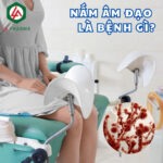 Nấm âm đạo là bệnh gì?