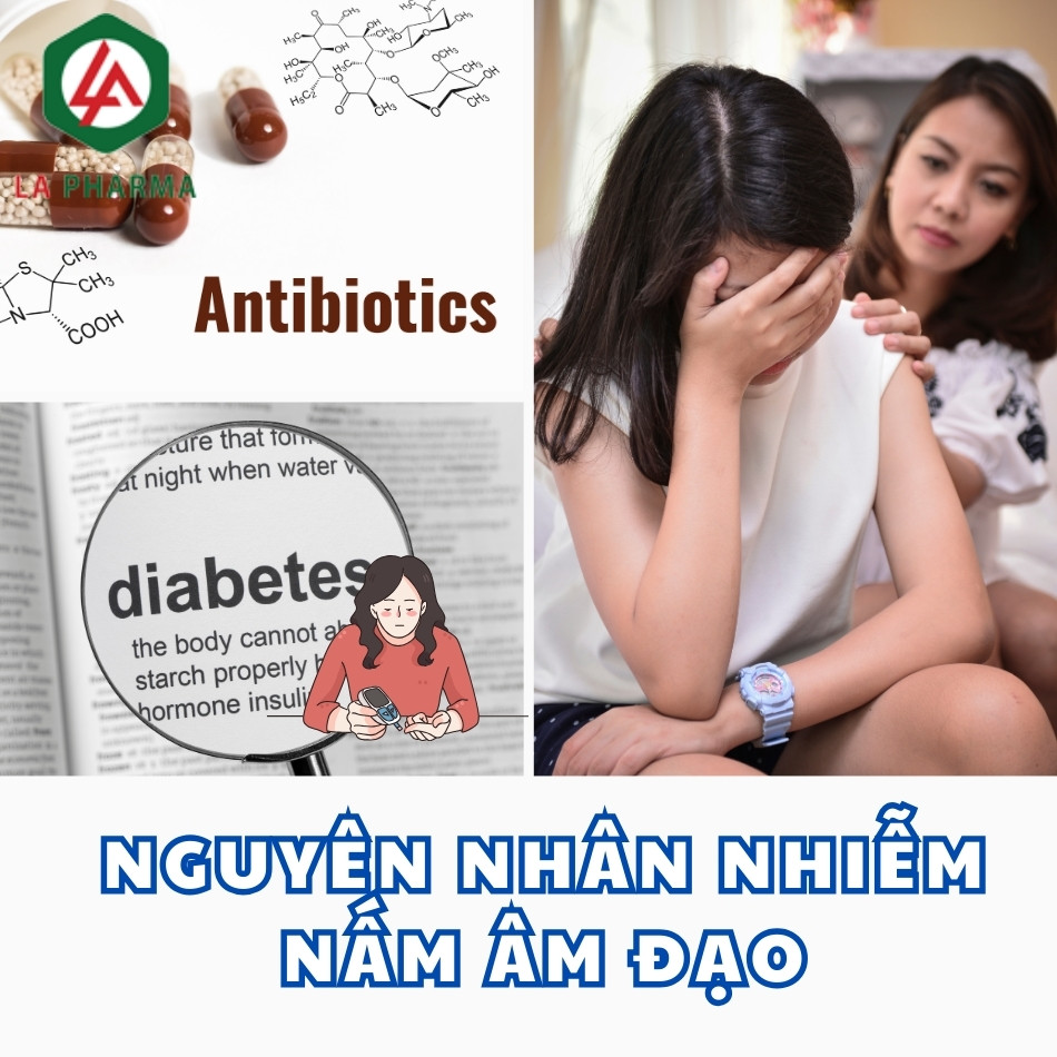 Nguyên nhân nhiễm nấm âm đạo