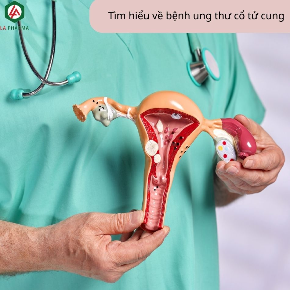 Tổng quan về bệnh ung thư cổ tử cung