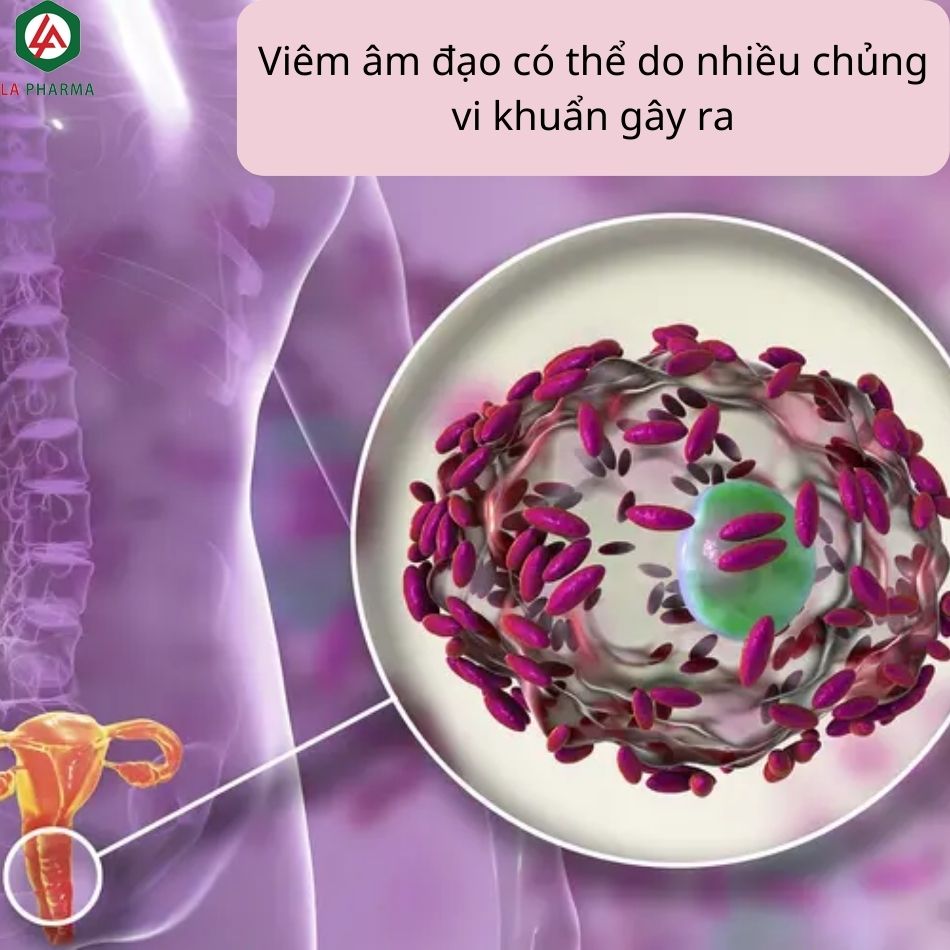 Viêm âm đạo do vi khuẩn: Tổng quan, dấu hiệu và phương pháp điều trị